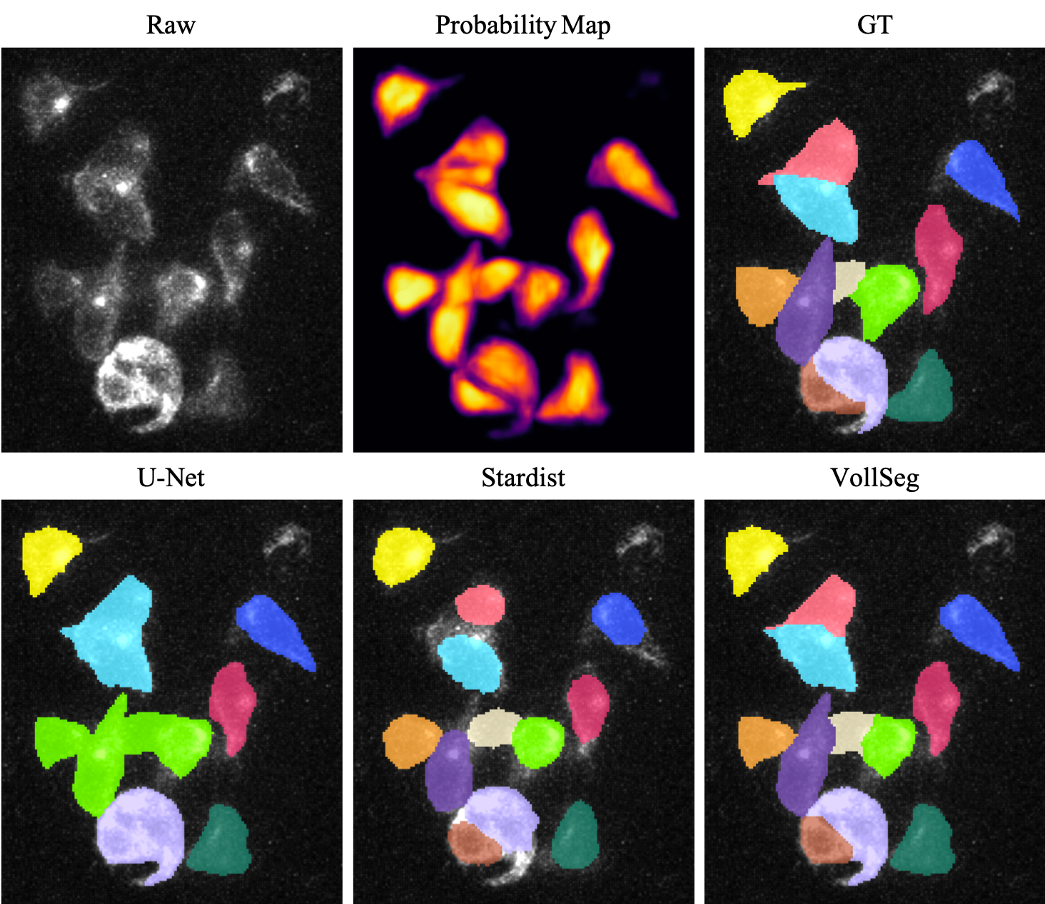 Mammary Gland Cells